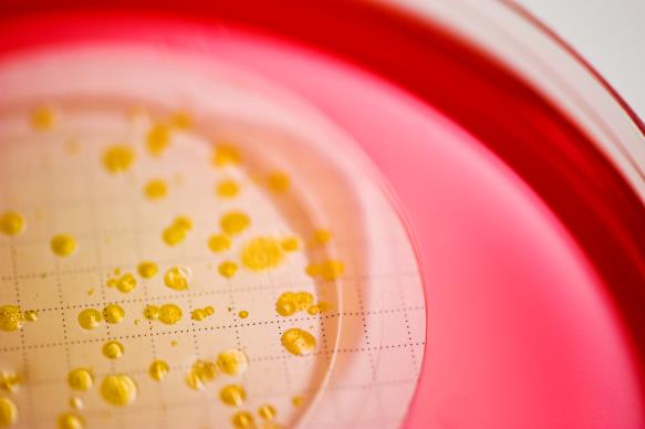 เมมเบรนกรองของทนร้อน-Coliforms-on-Differential-อุจจาระ-โคลิฟอร์ม-วุ้น